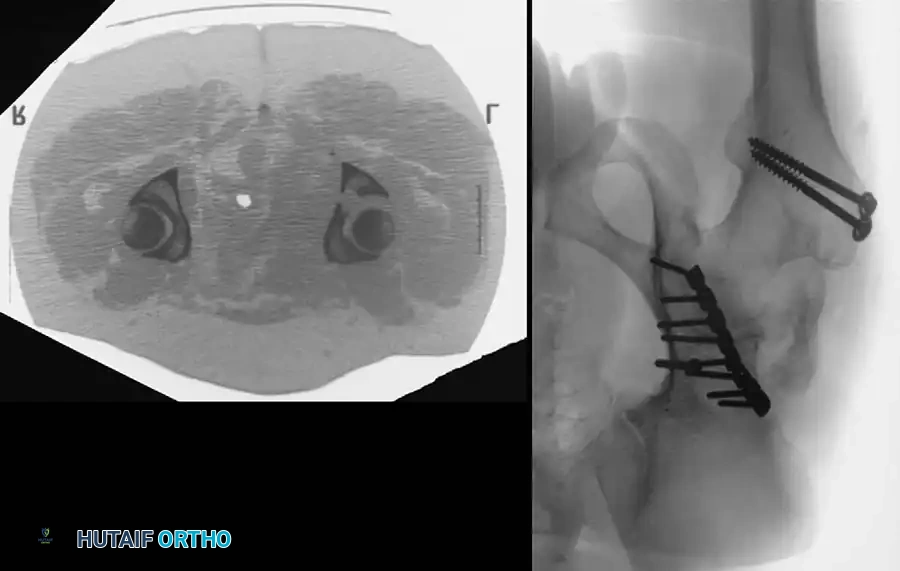 Hutaifortho's Orthopaedic Diagram
