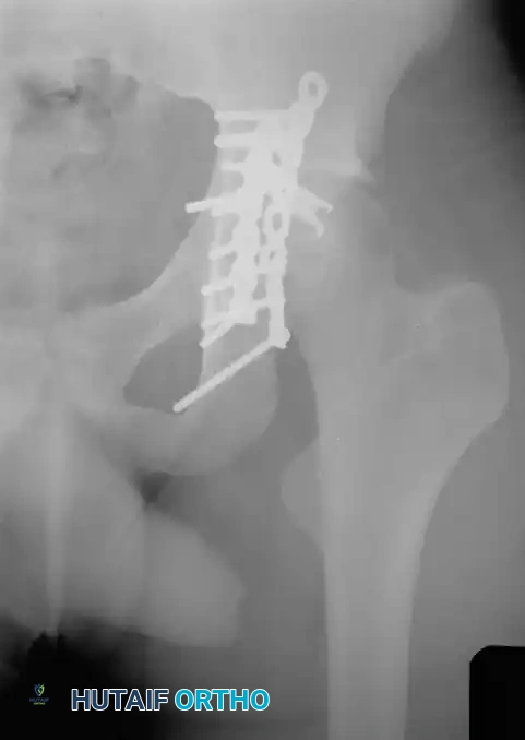 Hutaifortho's Orthopaedic Diagram