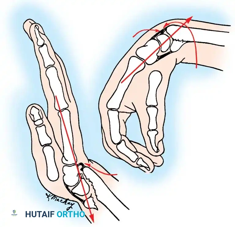 Hutaifortho's Orthopaedic Diagram