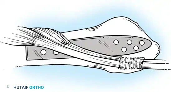 Hutaifortho's Orthopaedic Diagram
