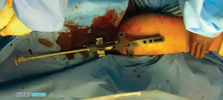 Hutaifortho's Orthopaedic Diagram