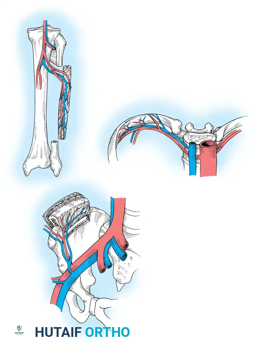 Free Vascularized Bone Transplant: Advanced Surgical Techniques and Principles