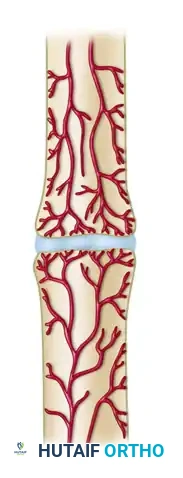 GENERAL TREATMENT OF NONUNIONS Surgical Diagram