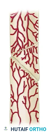 GENERAL TREATMENT OF NONUNIONS Surgical Diagram