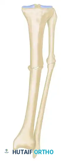 GENERAL TREATMENT OF NONUNIONS Surgical Diagram