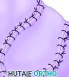 GRAFTS AND FLAPS Surgical Diagram