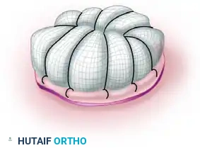 GRAFTS AND FLAPS Surgical Diagram