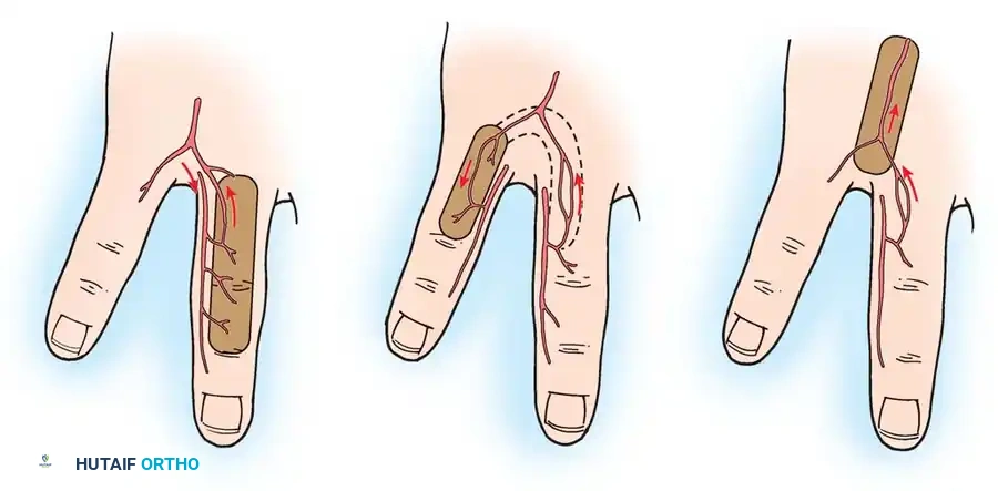 Hutaifortho's Orthopaedic Diagram