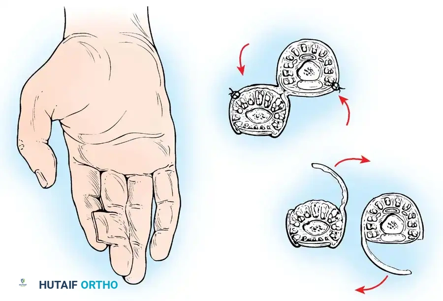 Hutaifortho's Orthopaedic Diagram