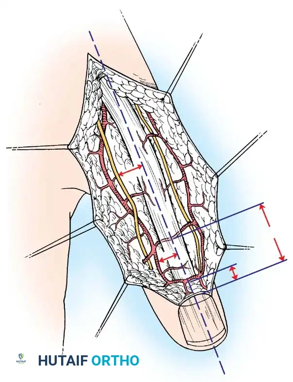 Hutaifortho's Orthopaedic Diagram