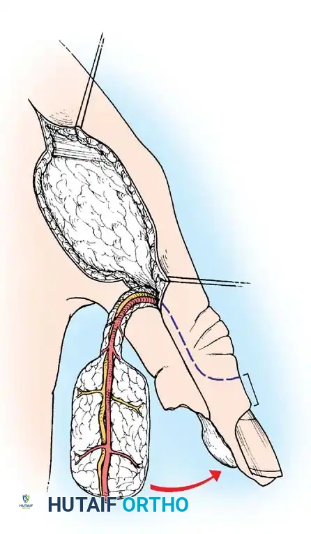 Hutaifortho's Orthopaedic Diagram