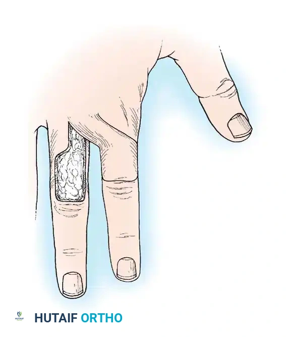 Hutaifortho's Orthopaedic Diagram