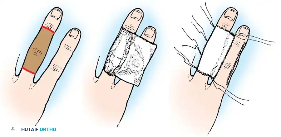 Hutaifortho's Orthopaedic Diagram