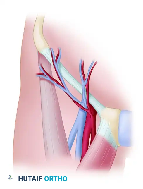 Groin Pedicle Flap: Surgical Technique & Anatomy