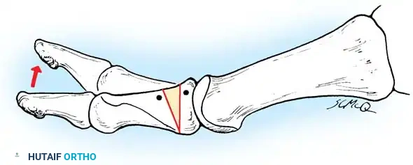 Hutaifortho's Orthopaedic Diagram
