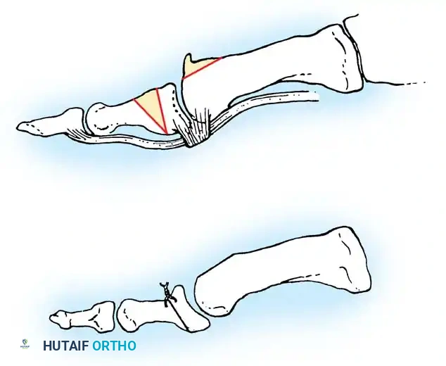 Hutaifortho's Orthopaedic Diagram
