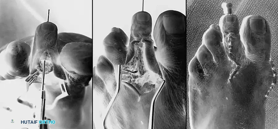 Hutaifortho's Orthopaedic Diagram