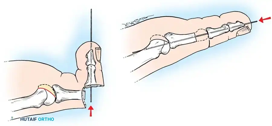 Hutaifortho's Orthopaedic Diagram
