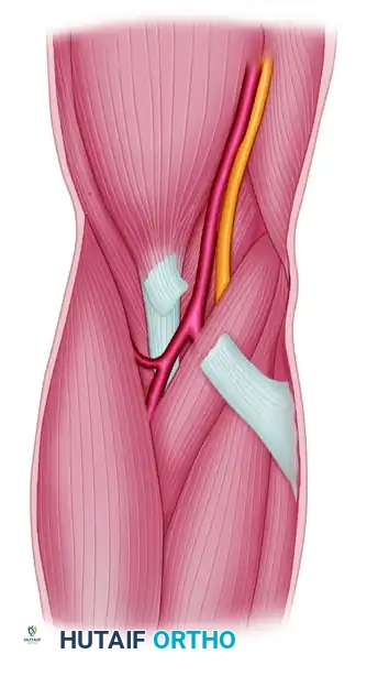 HAND FASCIOTOMIES Surgical Diagram