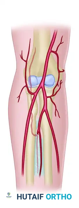 HAND FASCIOTOMIES Surgical Diagram