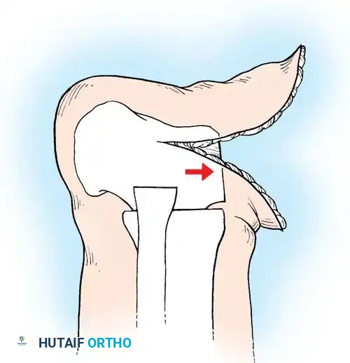 Hutaifortho's Orthopaedic Diagram
