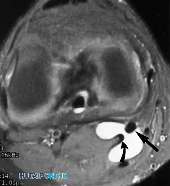 Dislocation of the Hip: Interactive Guide to Understanding DDH