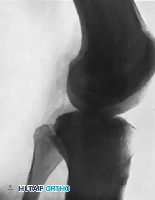 HIP Surgical Diagram