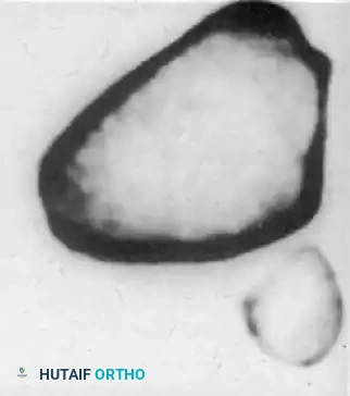 Hutaifortho's Orthopaedic Diagram