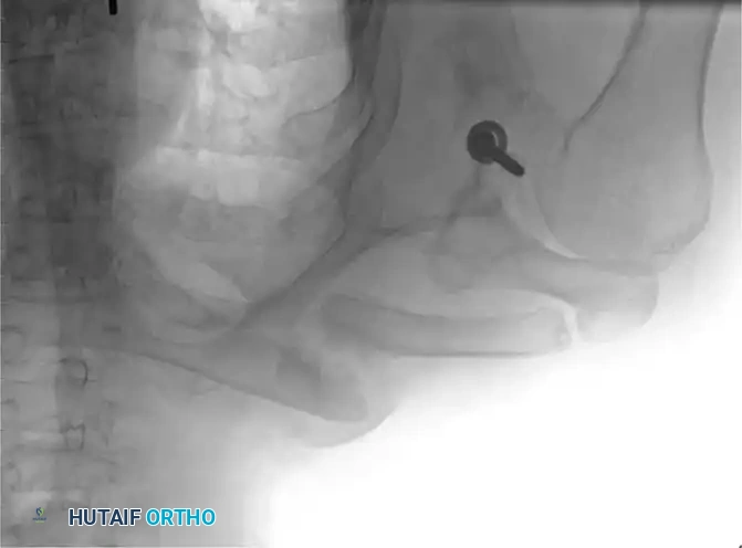 Hutaifortho's Orthopaedic Diagram
