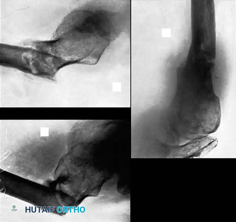 Hutaifortho's Orthopaedic Diagram