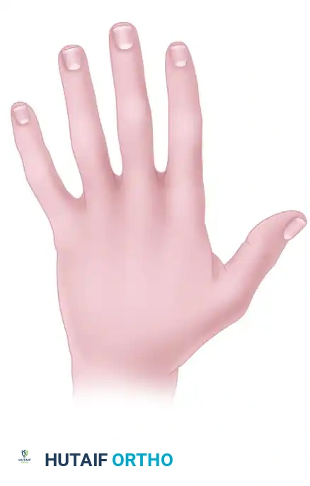 INCISION AND DRAINAGE OF DEEP FASCIAL SPACE INFECTION Surgical Diagram