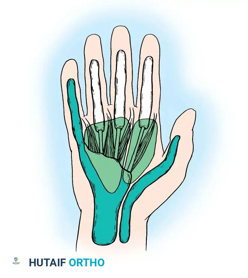 Midpalmar space Thenar space