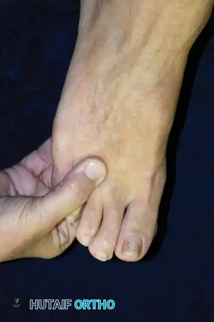 Mulder's Click Examination