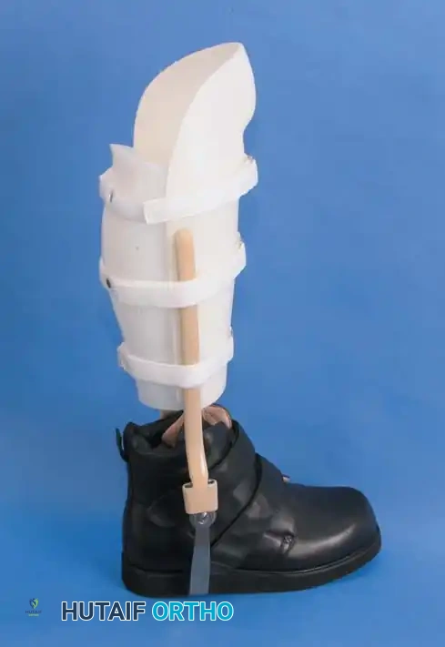 INTERNAL DERANGEMENTS Surgical Diagram