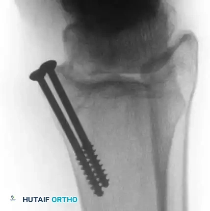 Hutaifortho's Orthopaedic Diagram