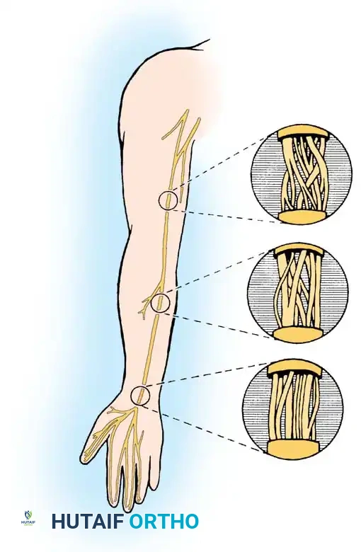 Peripheral Nerve Topography and Regeneration: A Comprehensive Surgical Guide