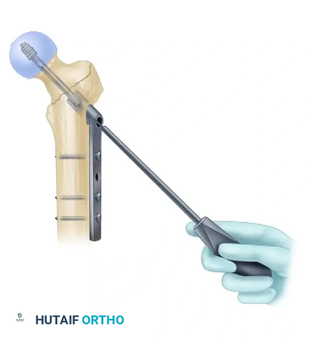 Hutaifortho's Orthopaedic Diagram