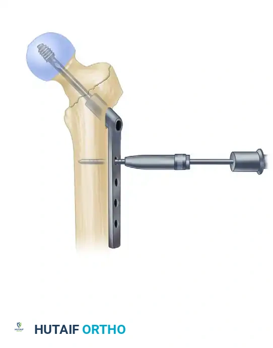 Hutaifortho's Orthopaedic Diagram