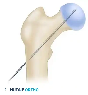 Hutaifortho's Orthopaedic Diagram