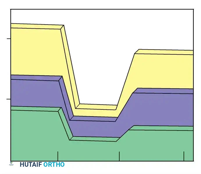 Juvenile Idiopathic Scoliosis: Comprehensive Principles and Operative Management