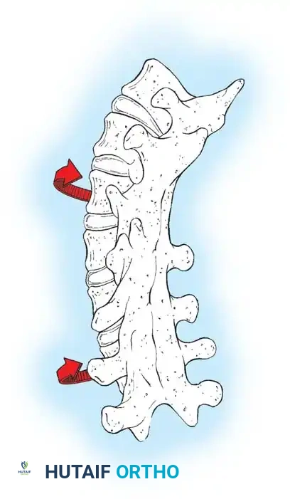 Crankshaft Phenomenon Diagram A