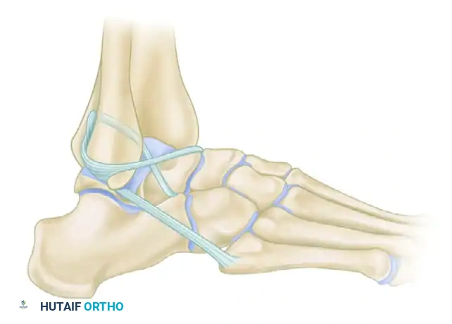 الدليل الشامل لعملية واتسون جونز المعدلة لعلاج عدم استقرار الكاحل المزمن