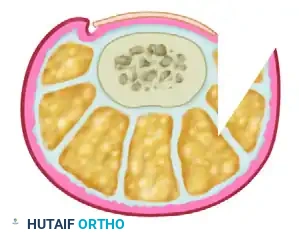 LONG-TERM FOLLOW-UP Surgical Diagram