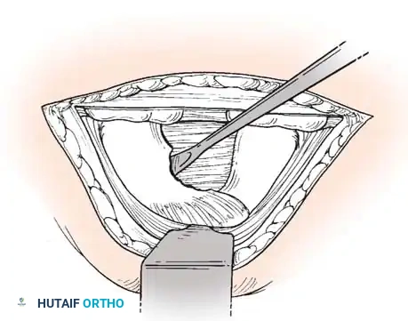 Hutaifortho's Orthopaedic Diagram