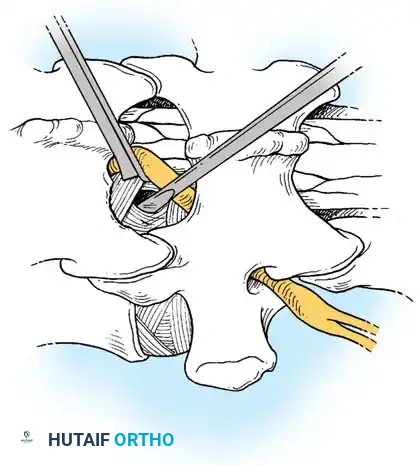 Hutaifortho's Orthopaedic Diagram