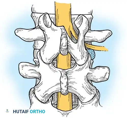 Hutaifortho's Orthopaedic Diagram