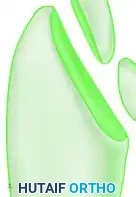 استئصال الجزء البارز من العظم بعد تعديل الزند