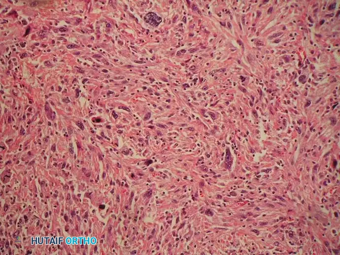 Hutaifortho's Orthopaedic Diagram