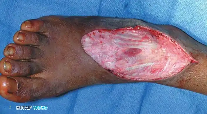 Hutaifortho's Orthopaedic Diagram