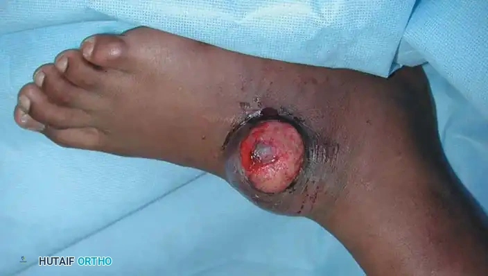 Hutaifortho's Orthopaedic Diagram